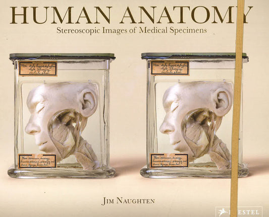 Human Anatomy: Stereoscopic Images Of Medical Specimens